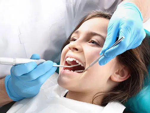 Minimally-Invasive SDF Treatment in Fairfield, CA - GV Smiles Pediatric Dentistry and Orthodontics 